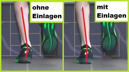 Wir finden für deinen Fuß die passende Einlage